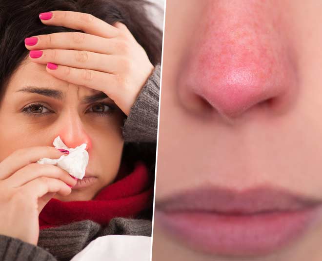 tips-to-keep-your-nose-warm-in-winter-tips-to-keep-your-nose-warm-in