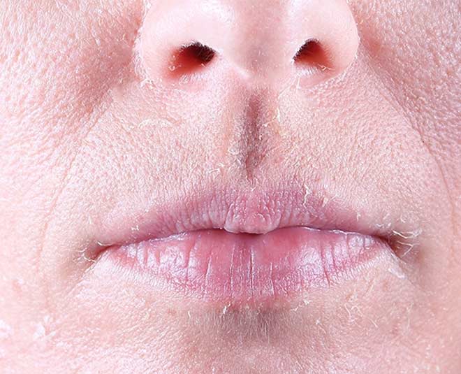 skin care while winter