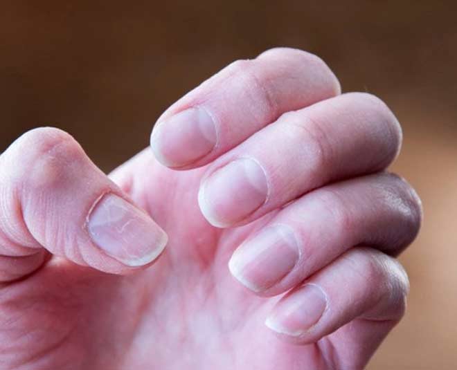 auspicious  signs  on  finger  nails