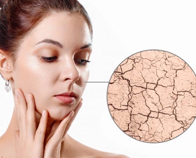 dry skin problems with nutrition