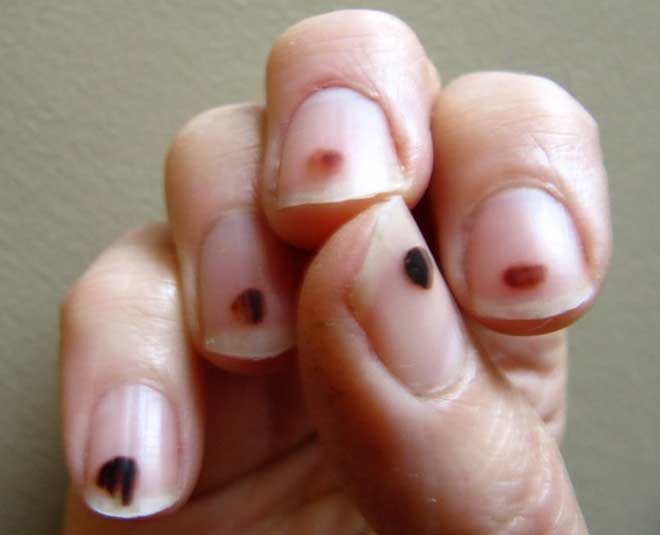 inauspicious  signs  in  palmistry