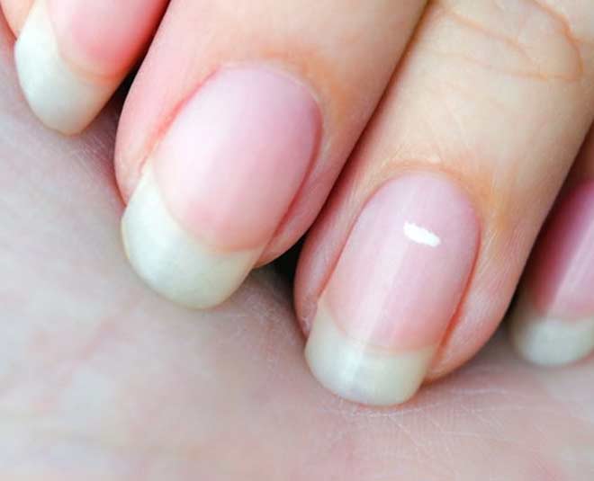 nail  abnormalities