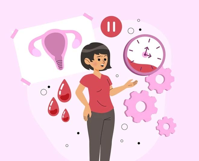 pcos and period delays