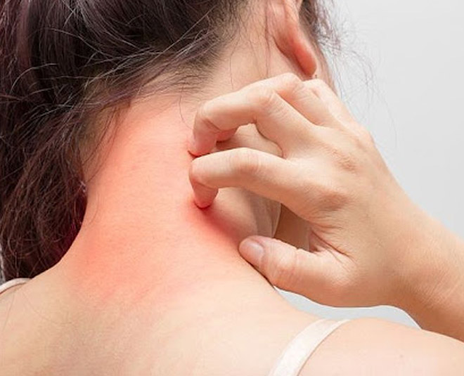 jackfruit seeds can cause allergy