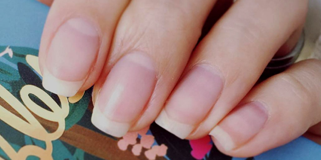 Things Your Nails Can Tell You About Your HealthThings Your Nails Can Tell You About Your Health