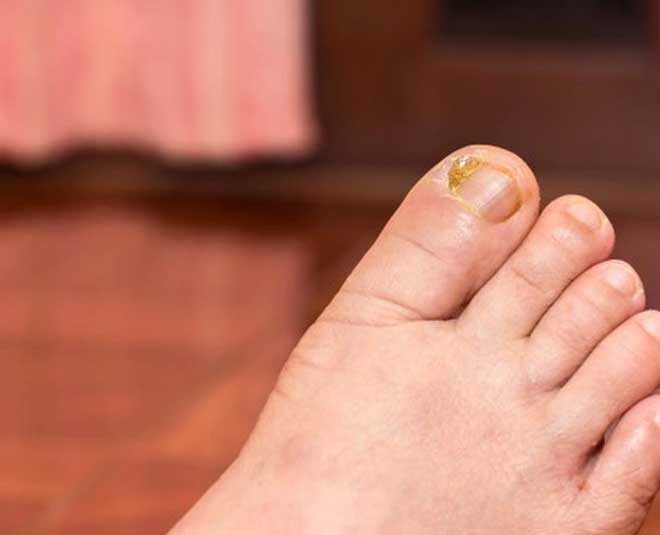 nail personality for humans