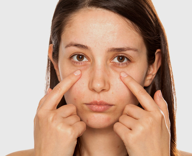 How To Get Rid Of Sunken Eyes How To Get Rid Of Sunken Eyes Herzindagi