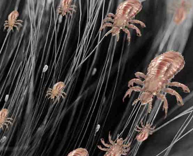 super fast tips lice