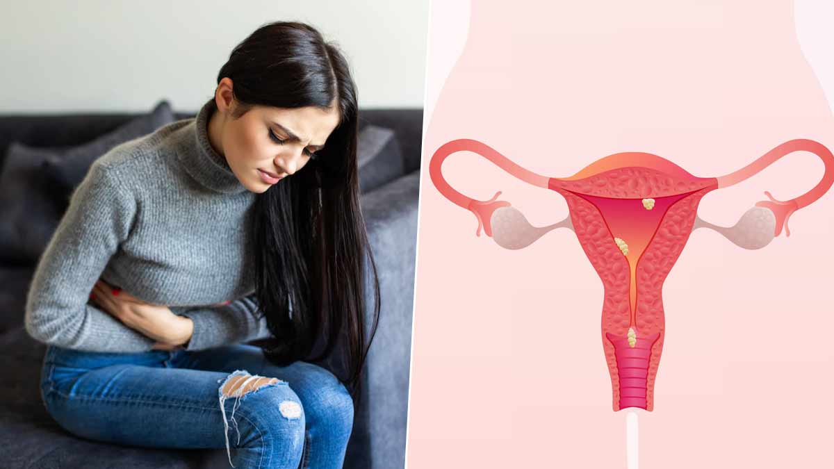 healthy uterus remedy  by expert