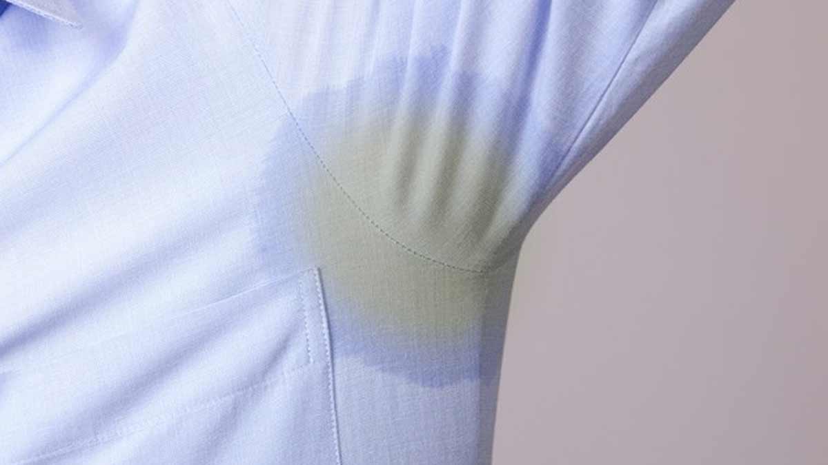 How to clean yellow stains from clothes
