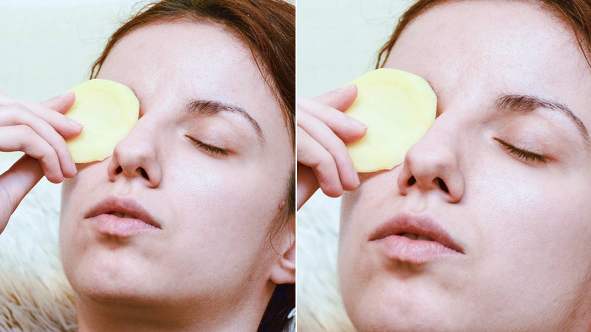 how-to-use-potato-on-face-potato-se-face