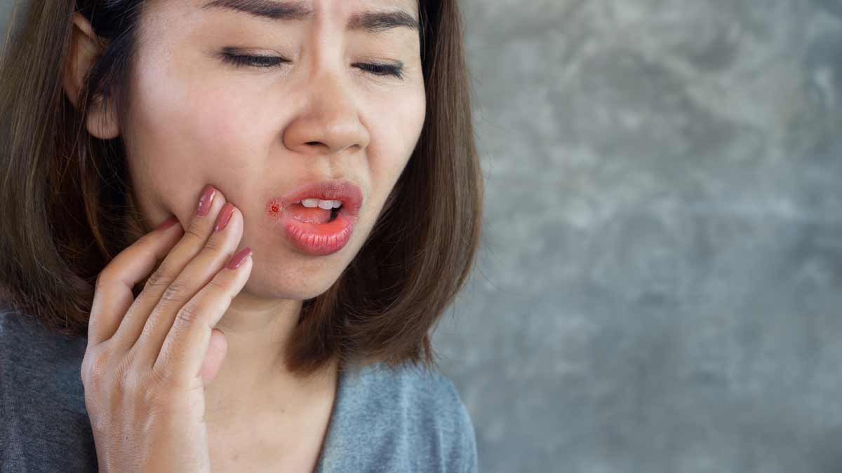 cracked lip corners ke upay