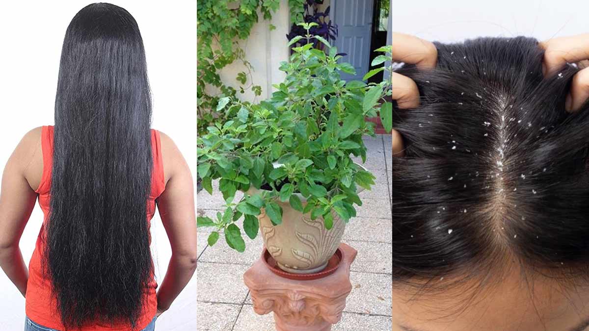 Tulsi For Hair| कैसे मिटाएं बालों से रूसी की समस्या| Tulsi Ke Gharelu Upay | tulsi ke upay for hair dandruff | HerZindagi