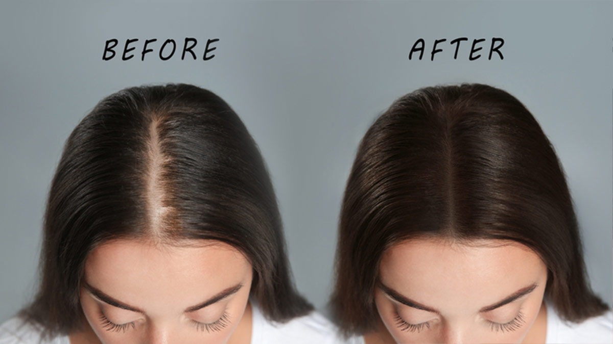How to do Straightening Thin Hair | हल्के बालों को Straight कैसे करें |  Hair Straightening - YouTube