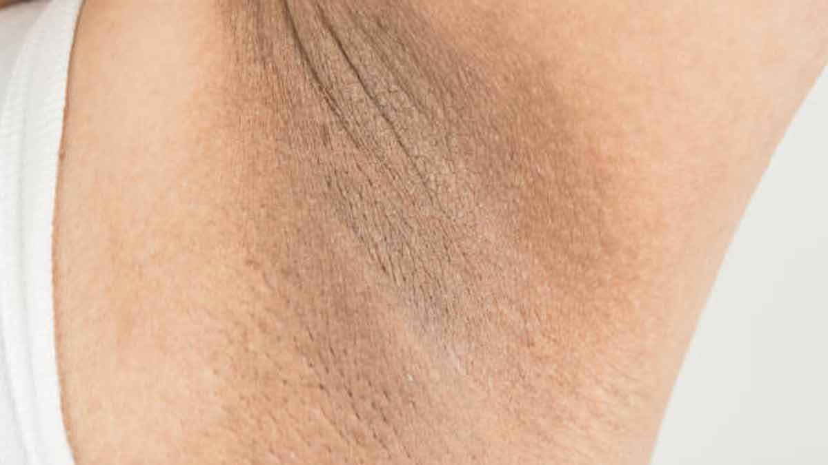 problems and underarms for darkness