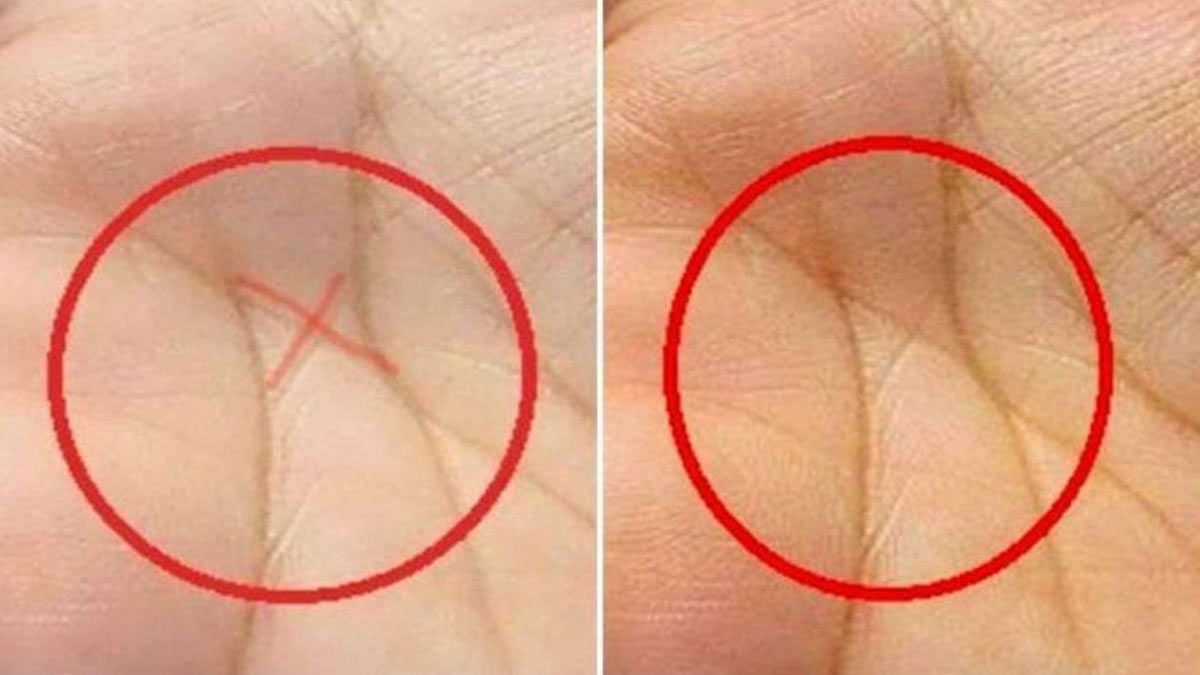 x on palm meaning according to expert