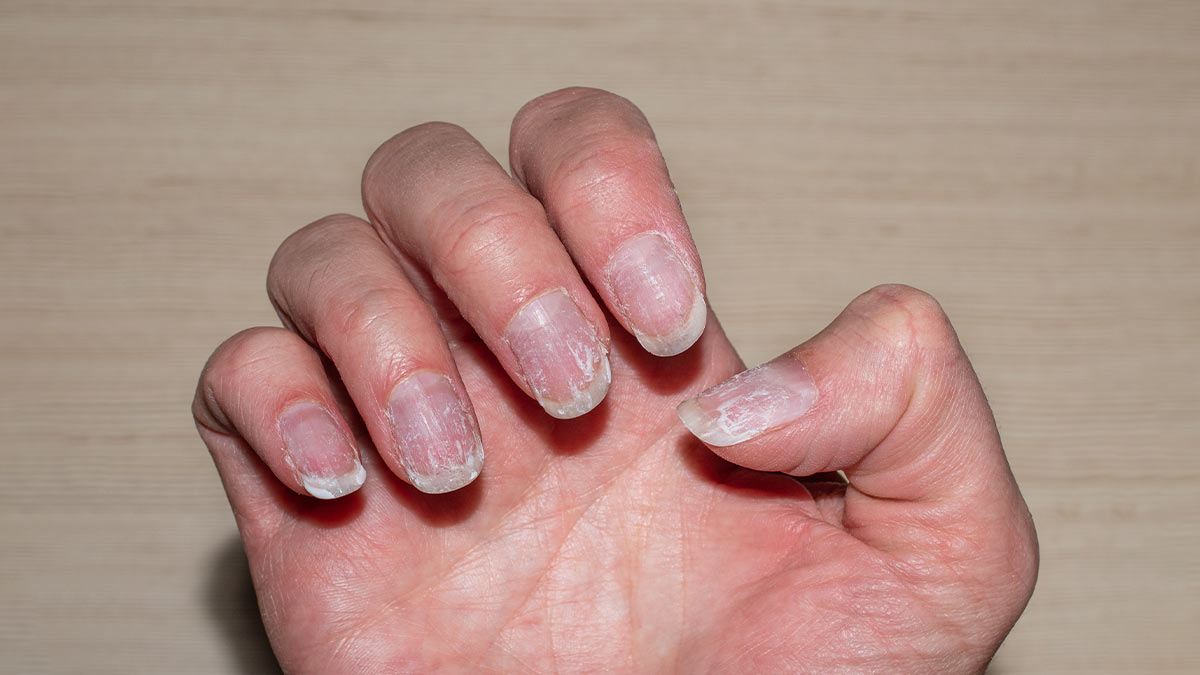 nails-care-tips-homemade-remedies-for