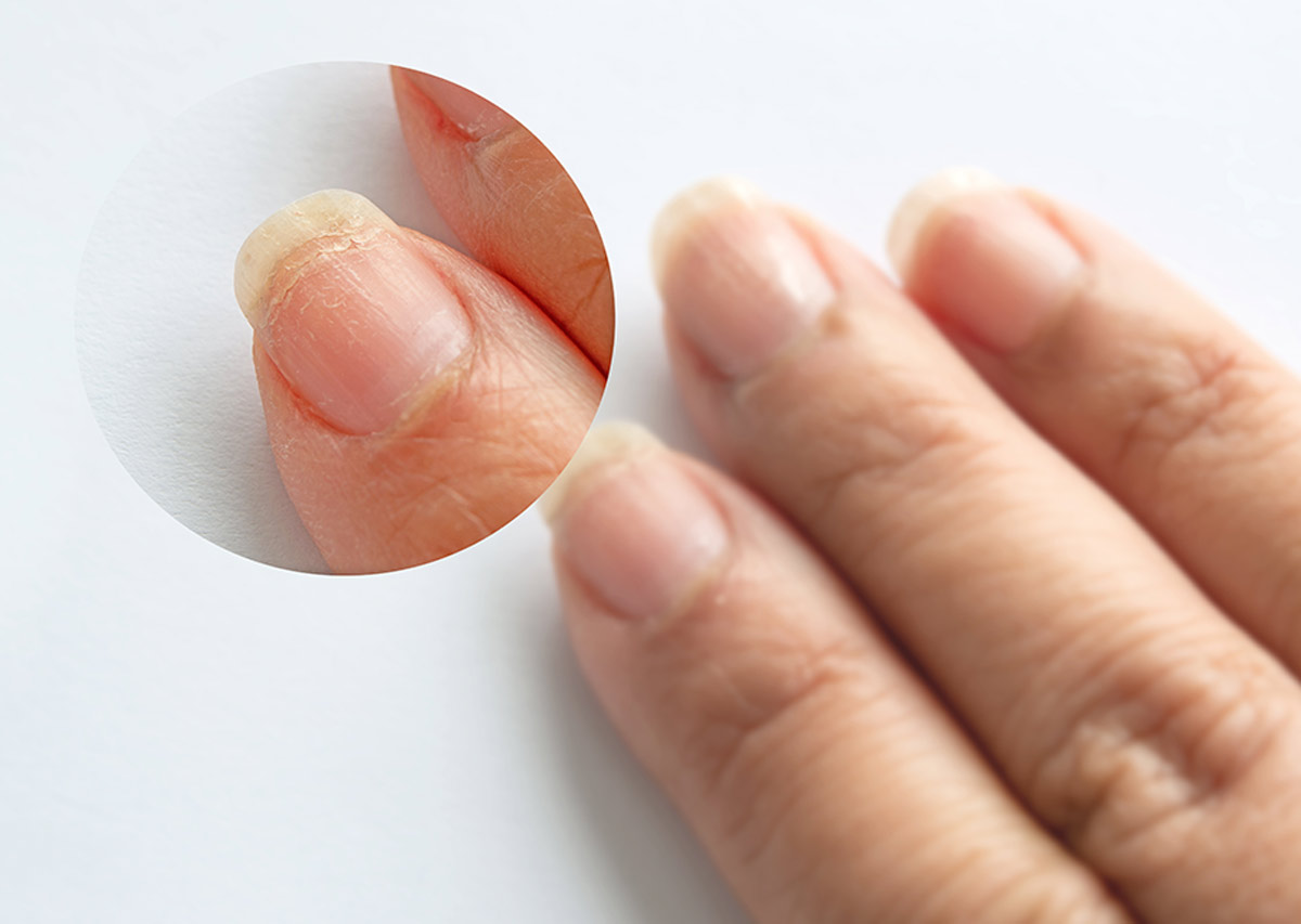 Nails Care Tipsनाखूनों की देखभाल कैसे करें Homemade Remedies For