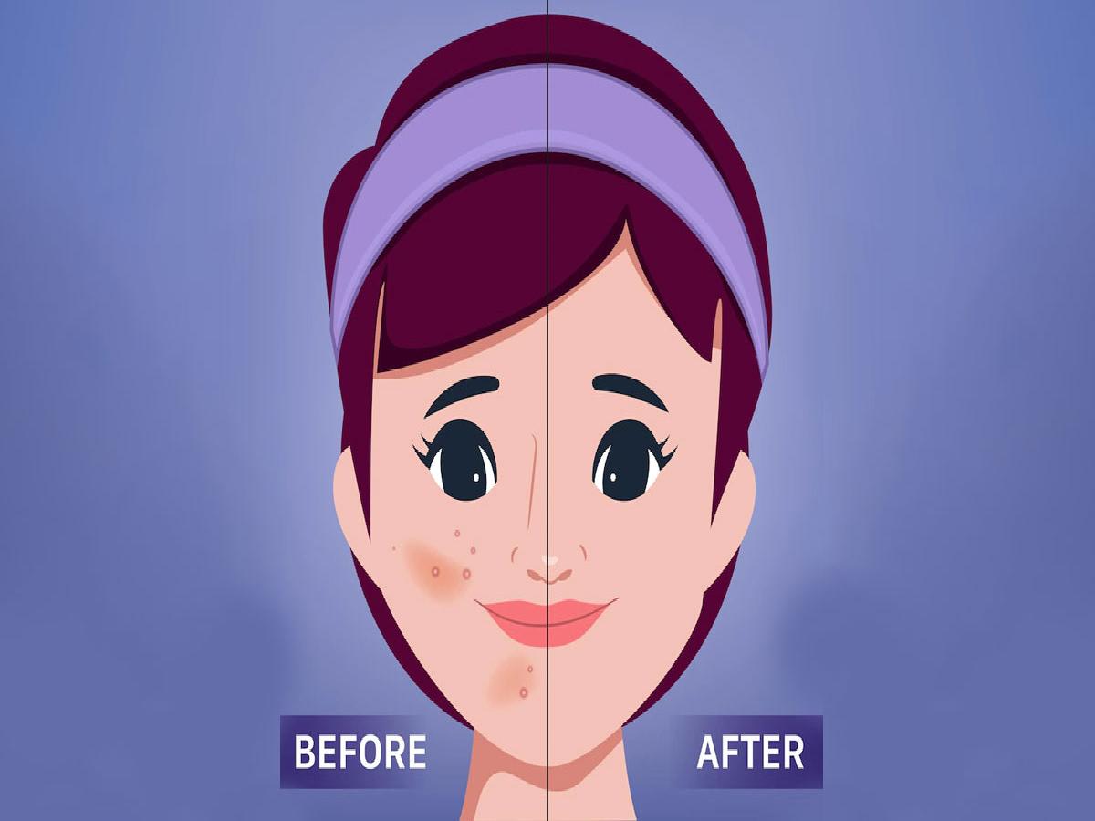 Skincare Routine For Oily Skin | Prep Your Skin | Skin Care Tips For Oily  Skin | HerZindagi