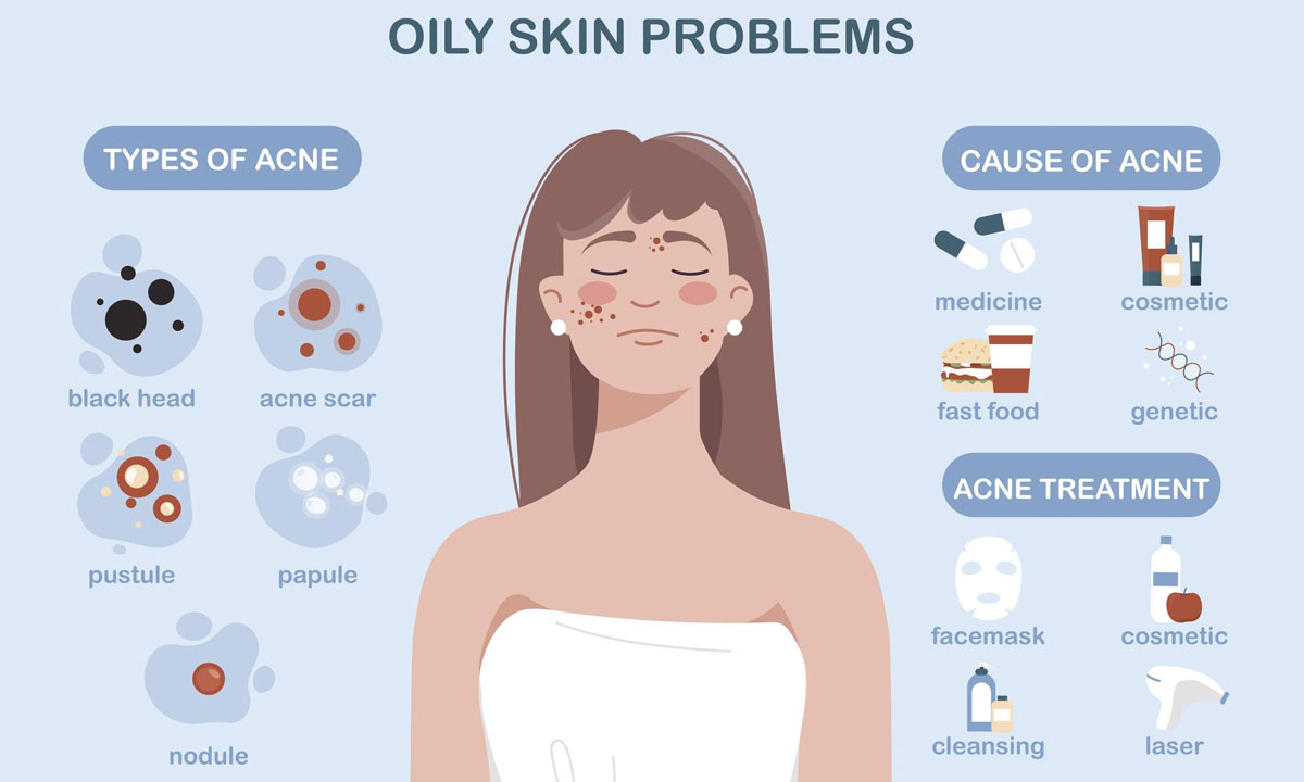 issues with oily skin