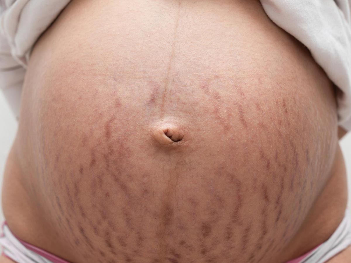 issues with pregnant women