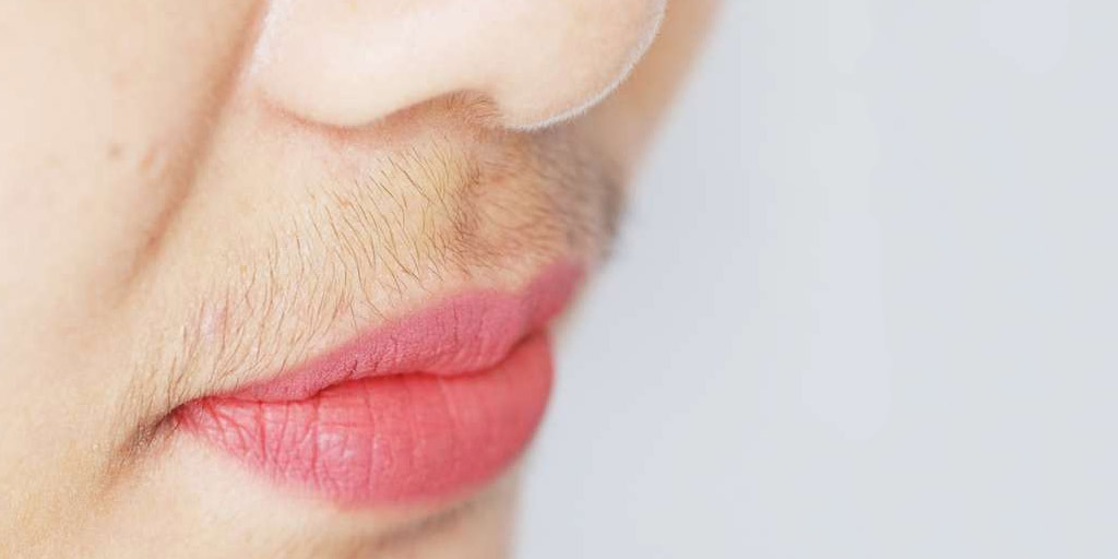 चेहरे के बाल कारण और इलाज Facial Hair Causes and Fixes Face Hair