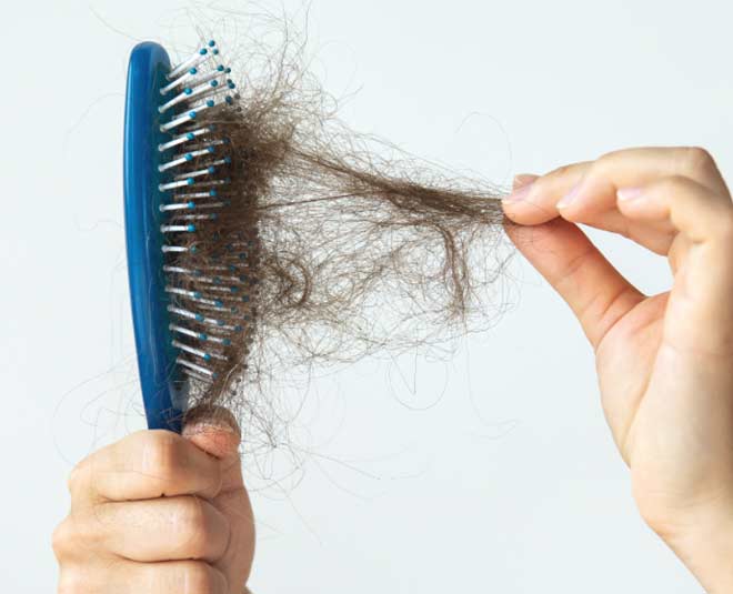 hair  fall  problem  loss