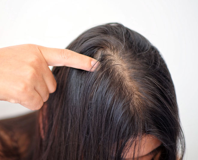 how to get rid from hair thinning