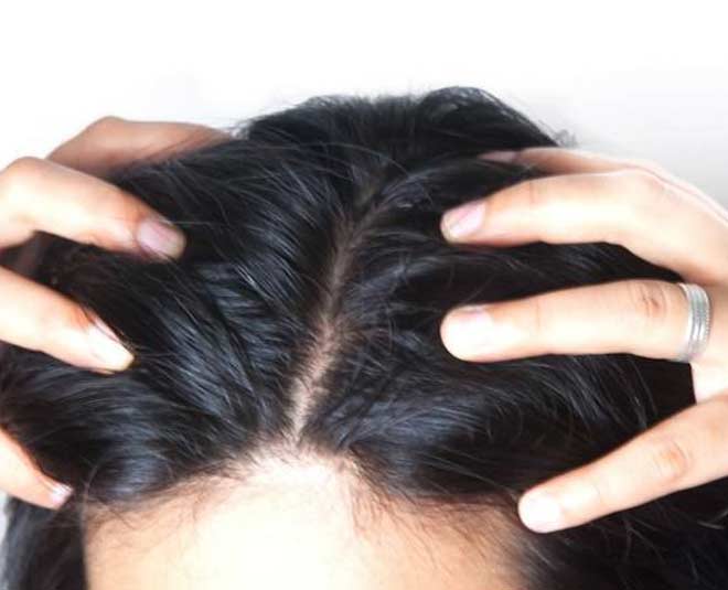 scalp winter essentials care