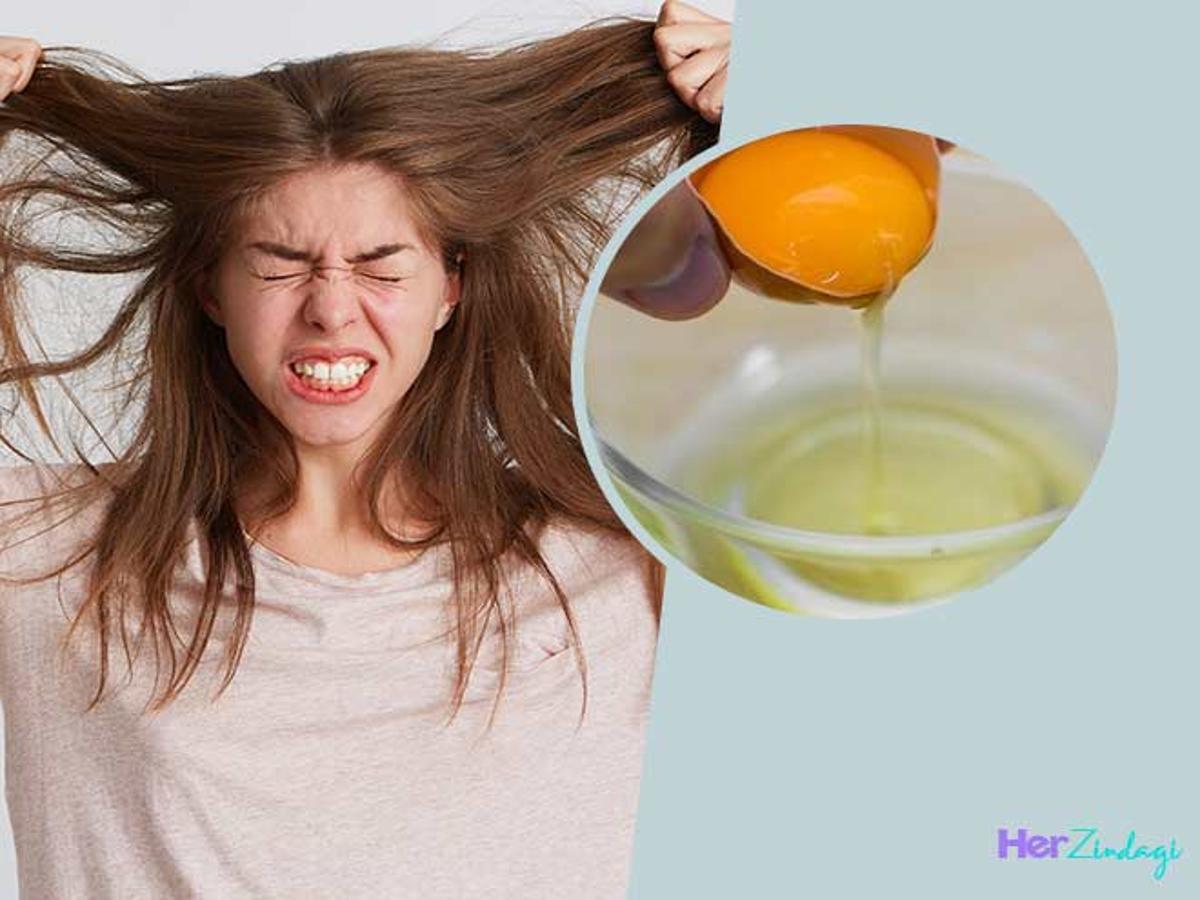 3 Ways to Use Egg White For Hair Dandruff by Shahnaz Husain | 3 ways to use  egg white for hair dandruff | HerZindagi