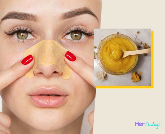Salme Forhåbentlig Stort univers Remove Blackheads On Your Nose At Home With These Easy DIY Masks And Scrubs  | HerZindagi