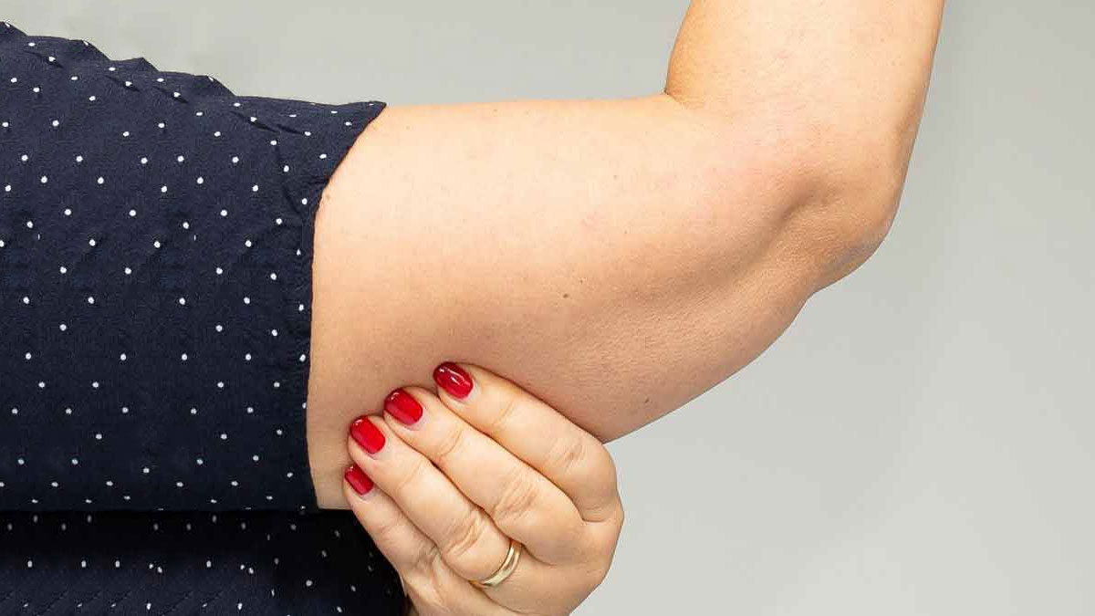 Foods To Reduce Arm Fat लटकती बाजुओं की समस्या Arm Fat Kaise Kam Kareलटकती बाजुओं से हैं