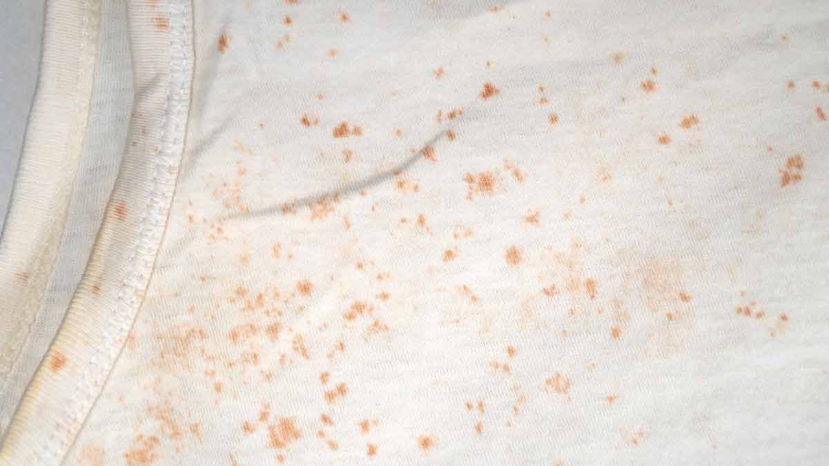 fungus from clothes in rainy season