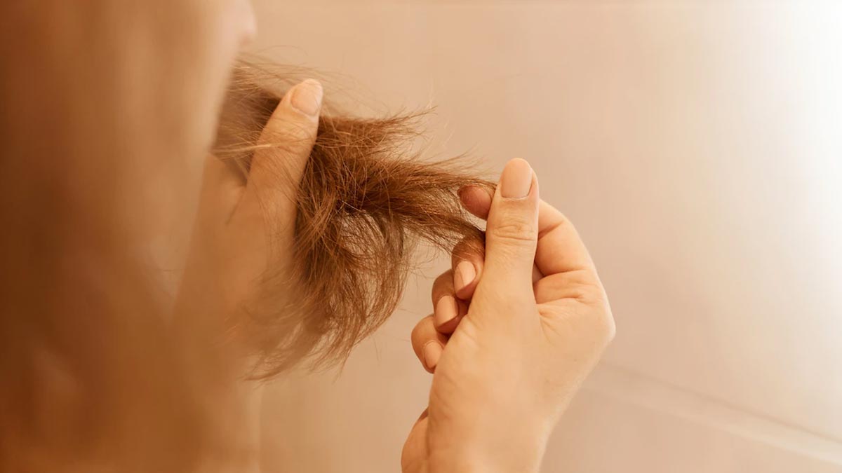 hair fall reason  pcos