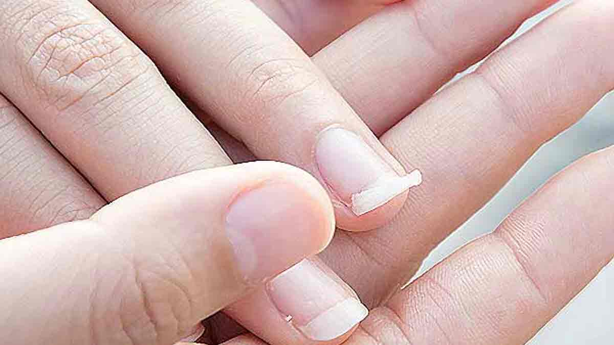nail care tips in monsoon