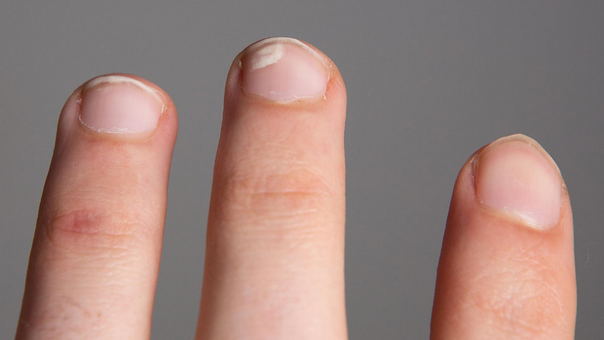 skin symptoms of  thyroid