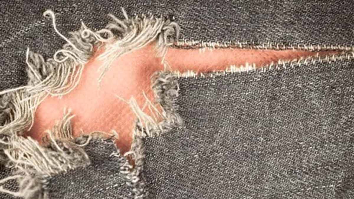 How to fix clothes holes