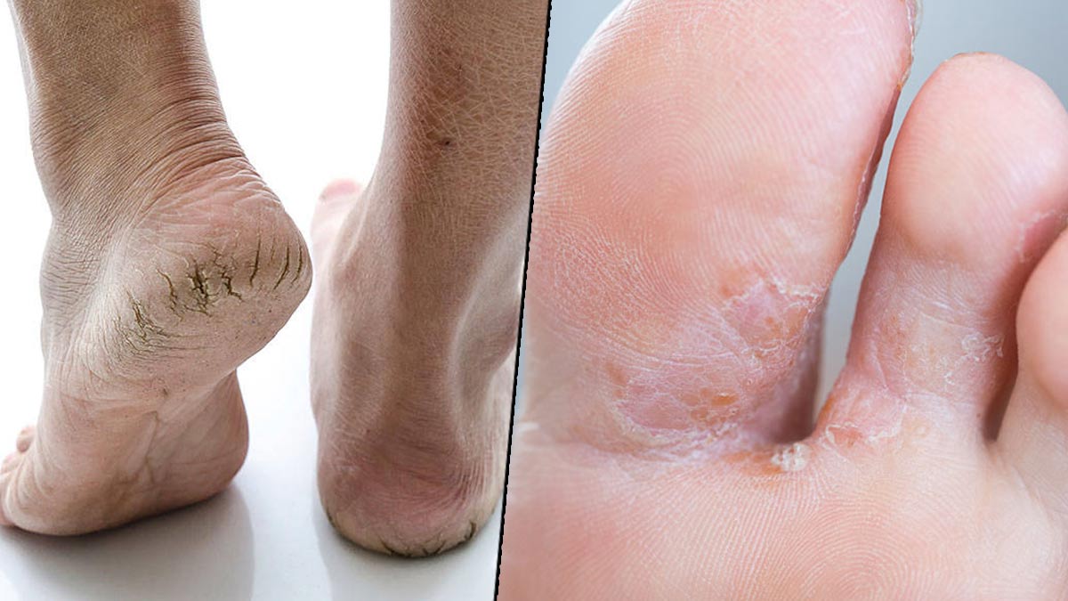 different ways to turn old and ageing feet beautiful