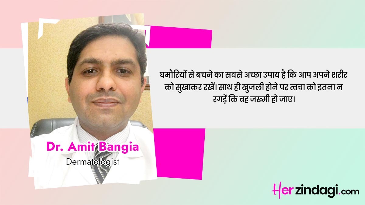 expert on heat rash