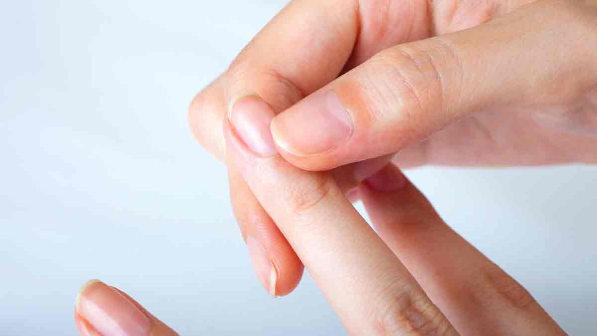home remedies for damaged nails hindi