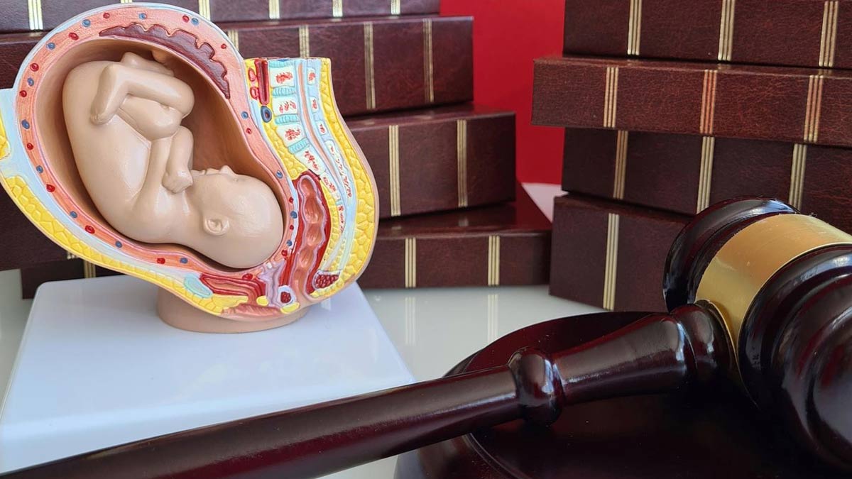 laws related to abortion