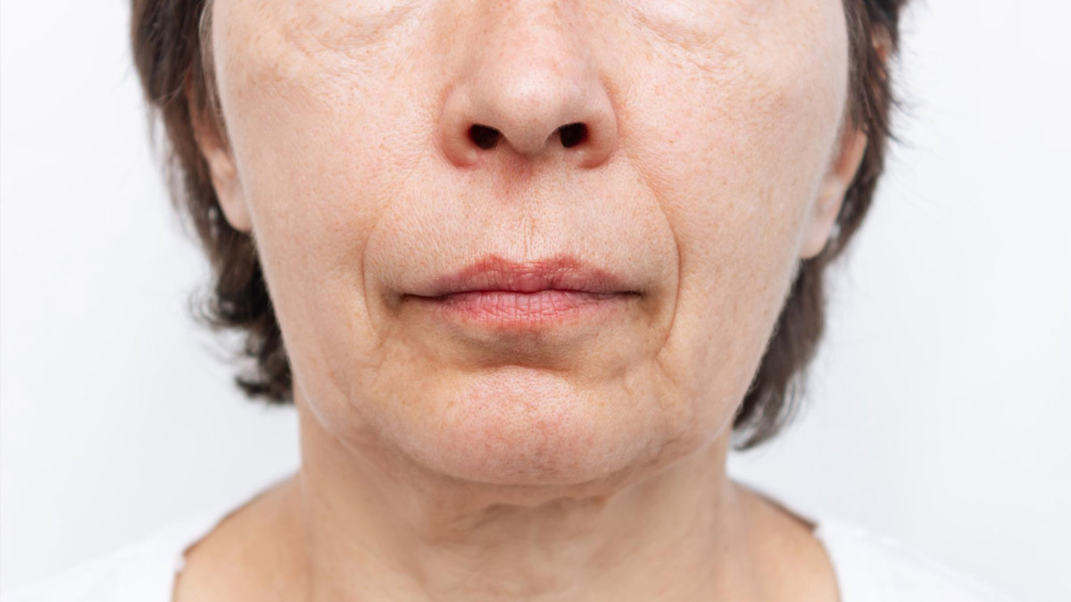 neck and sagging skin