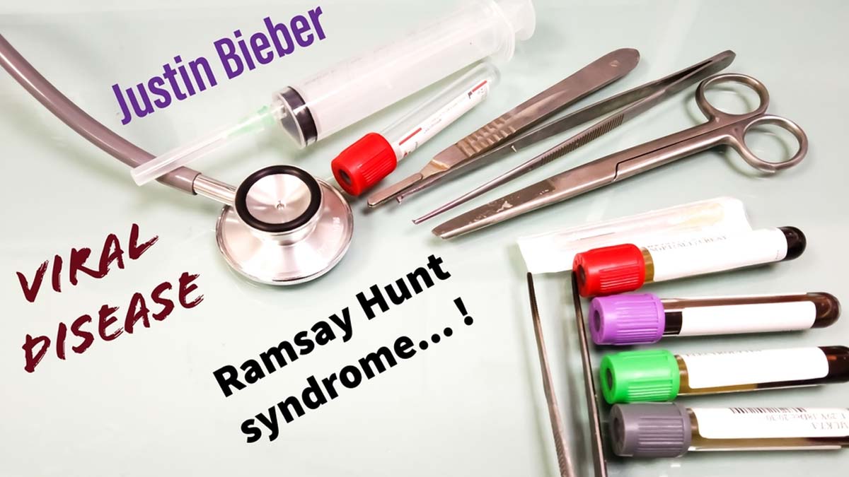 ramsay hunt syndrome