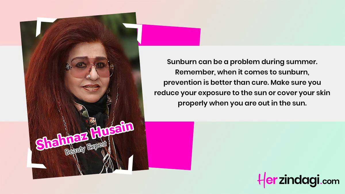 shahnaz husain on sunburn
