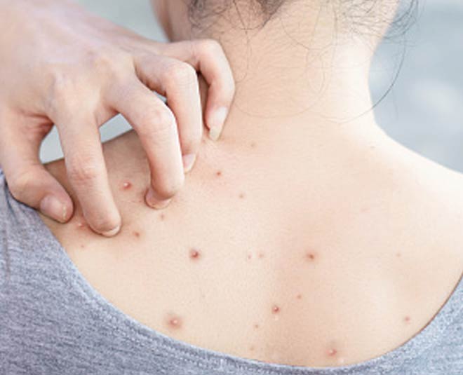 back issues and pigmentation