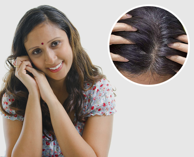 Hair Mistakes That Make You Look Older| सफेद बाल होने के कारण और उपाय| Baal Safed Hone Ke Karan in Hindi | hair mistakes that make you look older | HerZindagi Hair Mistakes That Make You Look Older| सफेद बाल होने के कारण और उपाय| Baal Safed Hone Ke Karan in Hindi | hair mistakes that make you look older | HerZindagi