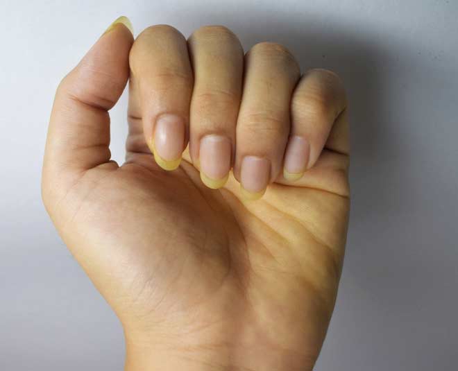 How To Get Rid Of Haldi Stains On Gel Nails