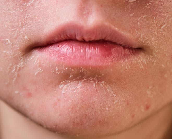 lips and skin dryness