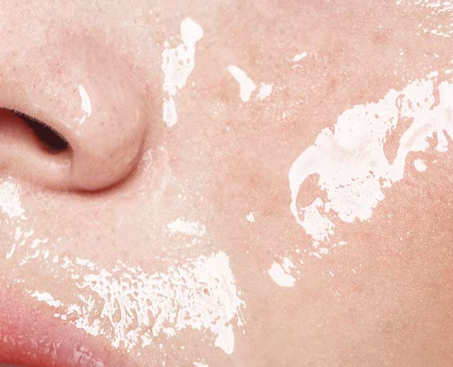 slugging benefits for dry skin