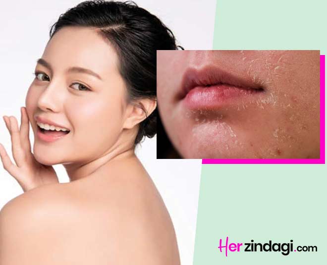 slugging for dry skin by expert